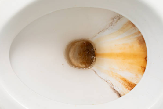 Thick, crusty white calcium and mineral deposits are visible around the base and aerator of a chrome bathroom sink faucet.